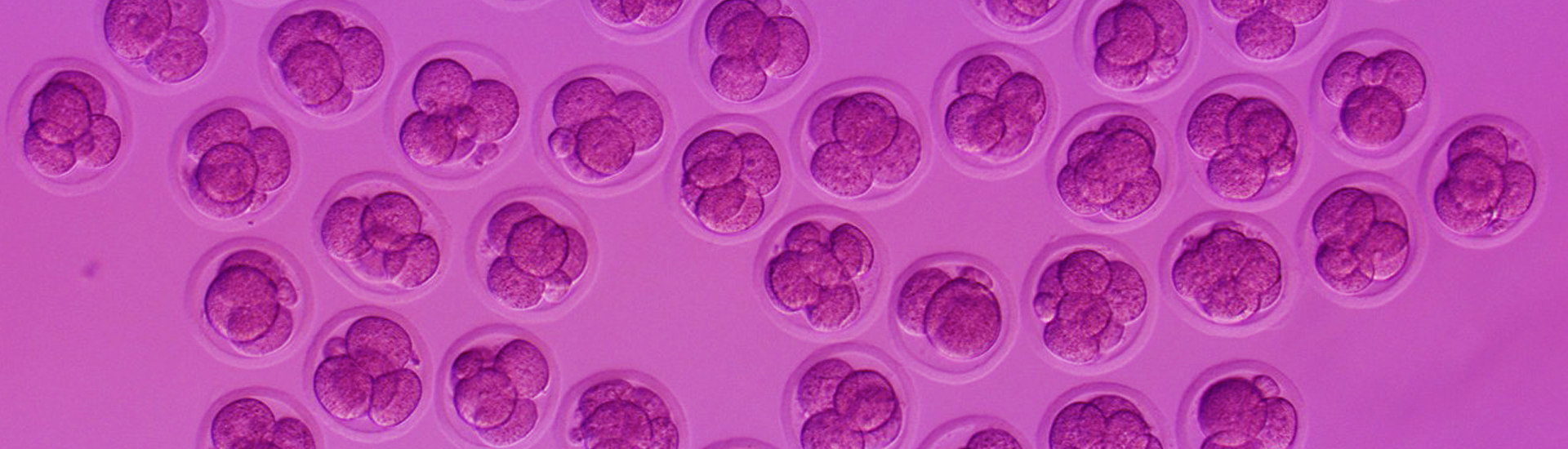 《自然》發表腦智卓越中心關于基因編輯技術RNA脫靶及其優化的研究成果